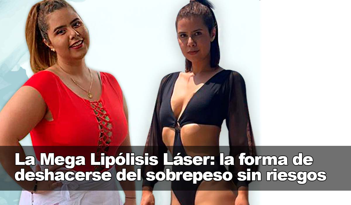 La Mega Lipólisis Láser: la manera de deshacerse del sobrepeso sin problemas